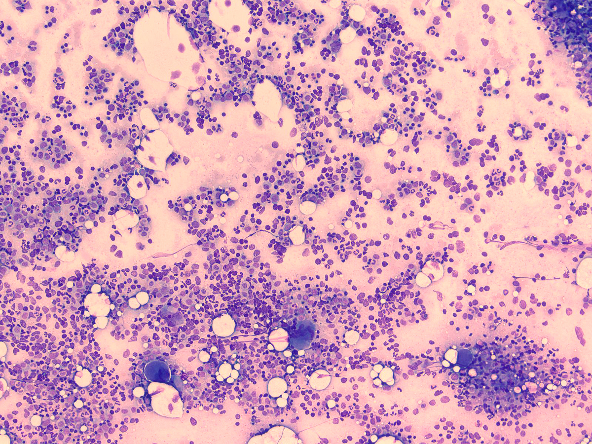 Image 4 aspirate 10x